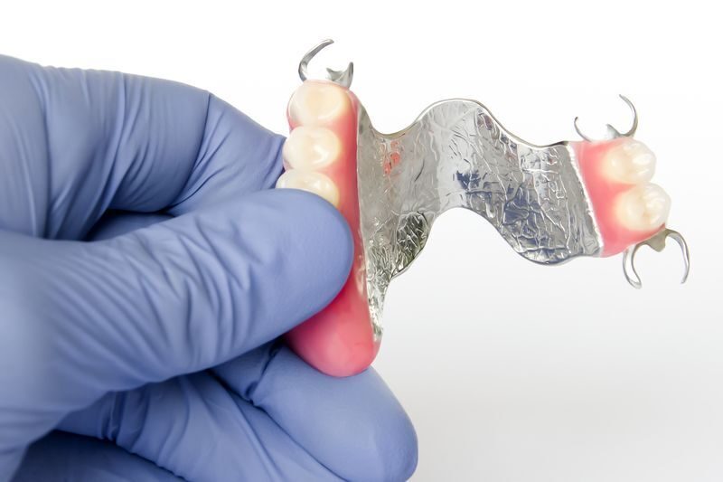 стоимость протезирования зубов