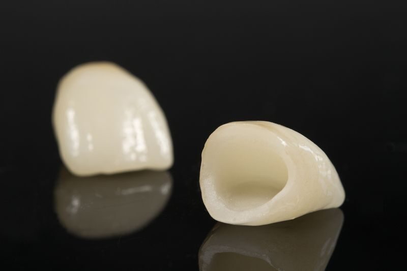 Зубные коронки: вид снизу и спереди