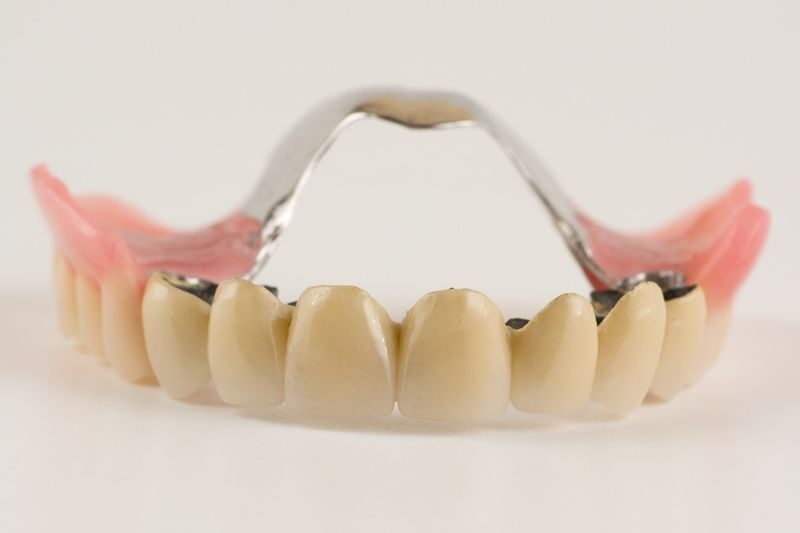 стоматология протезирование зубов
